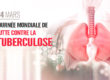 Journée mondiale de lutte contre la tuberculose